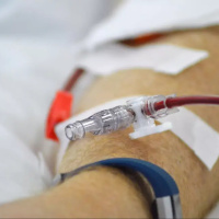 Donor lymphocyte infusion (DLI) (patient information)