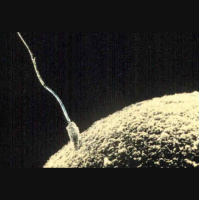 IVF ontwikkeling in Nederland, 11.17