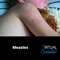 Episode 336: #78-3 Measles: Controlling the Spread