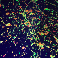 How to Rewire Your Brain