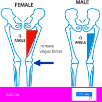 Knee Deep in Trouble: Why ACL Injuries Plague Womens Soccer