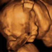 La ecografía de la semana 20 de embarazo