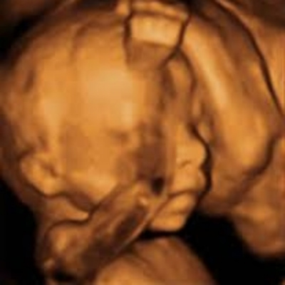 Cómo Nos Ha Cambiado La Vida