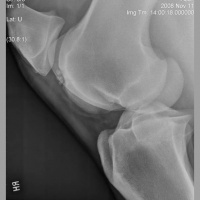Episode 5 - Radiography health and safety