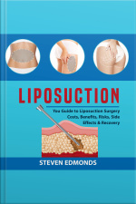 Liposuction: You Guide To Liposuction Surgery Costs, Benefits, Risks, Side Effects  Recovery