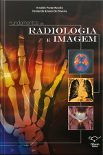 Fundamentos De Radiologia E Imagem