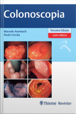 Colonoscopia