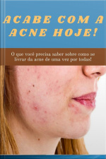 Acabe Com A Acne Hoje!