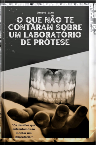 O Que Não Te Contaram Sobre Um Laboratório De Prótese