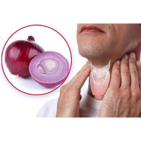 Know How To Get Rid Of Thyroids Naturally