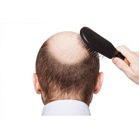 Simple Tibetan Remedy To Cure Hair Loss