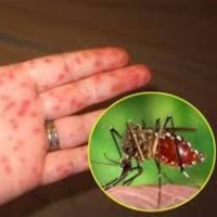 Trẻ em bị sốt xuất huyết- Lưu ý ngày nguy hiểm dễ diễn biến nặng