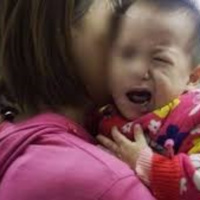 Trời trở lạnh, trẻ em cũng có thể trúng gió, liệt dây thần kinh số 7