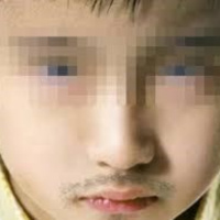 Nguyên nhân dậy thì sớm, có sự khác nhau rõ rệt giữa nam và nữ