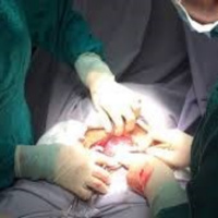 Ngày càng nhiều phụ nữ Việt Nam sinh mổ