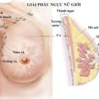 Áp- xe vú sau sinh- các mẹ cho con bú không thể chủ quan