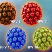 Các bước theo dõi sau khi phát hiện ra nhiễm HPV, loại virut gây ung thư cổ tử cung