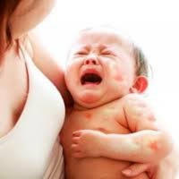 Khi con có những triệu chứng này cha mẹ cần nghĩ đến dị ứng thức ăn