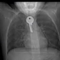 Trẻ nghịch dại theo các video trên mạng, cha mẹ phải làm gì?