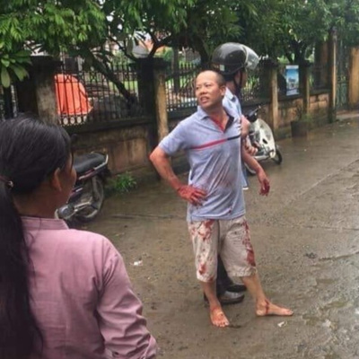 Vov - Chng Trinh Thi S