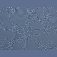 Dragocenosti v biobanki – zdravljenje z matičnimi celicami