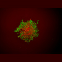 Obeti nanotehnologij in varnost nanodelcev