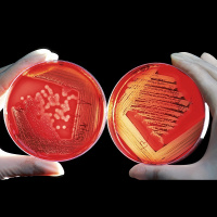 Ķīmisko vielu biomonitorings