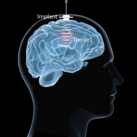 Ultrasound device could aid brain cancer treatment