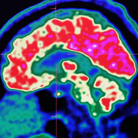 Tech that can read our minds takes a step closer