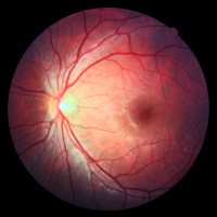 Japans stem-cell race