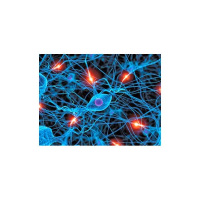 D4T • Myth Of Fibromyalgia