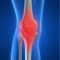 Episode #201: What To Do About Knee Pain That Won’t Go Away
