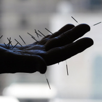 #103 From Acupuncture to a Back-Stabbing Betrayal