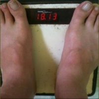 Weightloss Wednesday 2010 - Wk 0