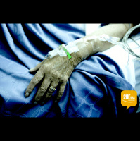 Fight for Dying with Dignity