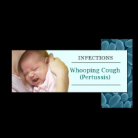 Pertussis