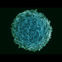 Clinical Trials and Tribulations: Steve Hausers quest to cure MS