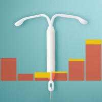 Implants and IUDs: A Renaissance of Birth Control