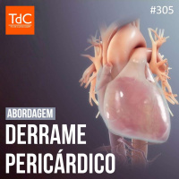 TdC 305: Abordagem de Derrame pericárdico