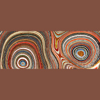 Podcast 124 - A Second Opinion