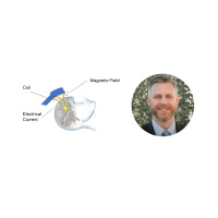 E5 - Good Vibrations: What can transcranial magnetic stimulation do for mental health?