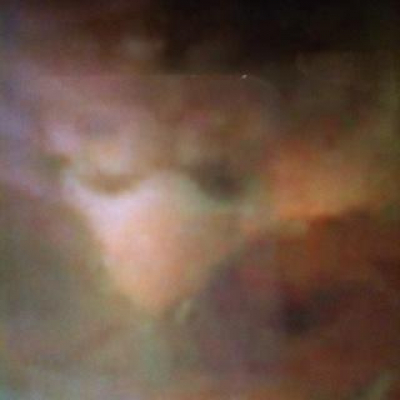 Dr Vinyl Burnss Posts