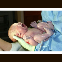 Post Birth Abortion – The Next Step