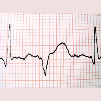 E6S-209 Process Pulse Part 1 - Statistical Process Control (SPC) 