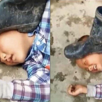 Self-Inflicted Punishment (Ep 385)