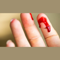 Were Abortions Induced on Old Testament Adulteresses?