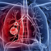 Embolia gasosa no intra-operatório