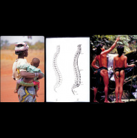 The J Shaped Spine Part Deaux 