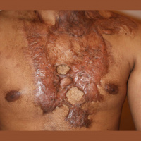 Episode #7 How to tell if scars are getting in the way of your healing process, The little known way to unleash your bodys healing potential, How to tell if hidden food sensitivities are driving disease in your body, Are beets the best food for boosting 