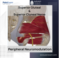 Superior Gluteal and Clueneal Nerve Stimulation